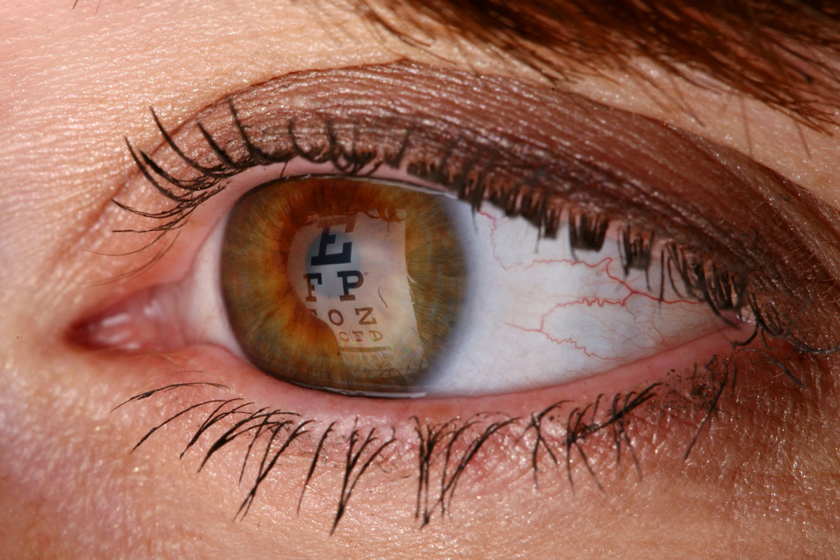 Eye Exam McAllen